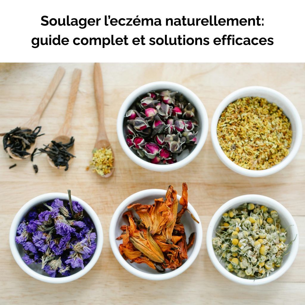Soulager l’eczéma naturellement: guide complet et solutions efficaces
