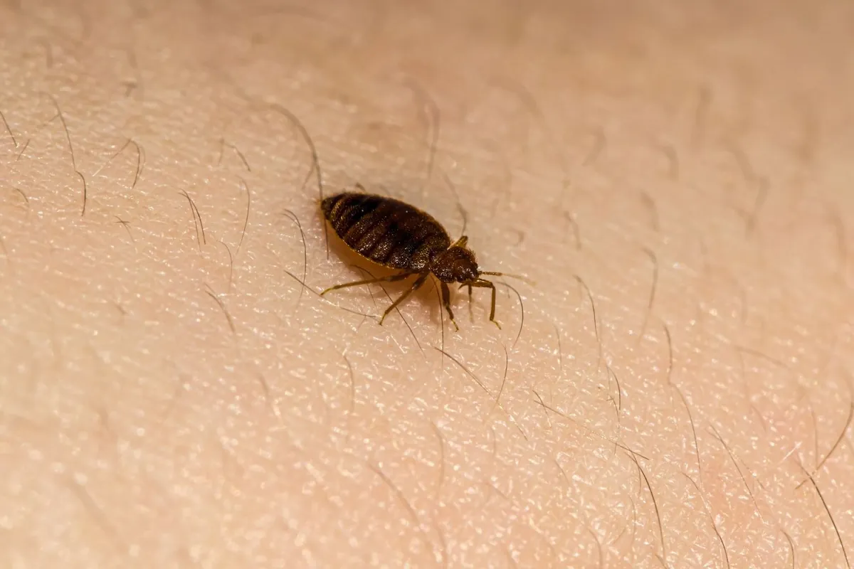 Punaise de lit adulte sur la peau humaine, insecte brun ovale et aplati